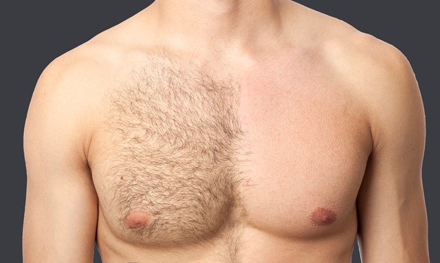 How To Remove Nipple Hair Without Hurting Your Boobs